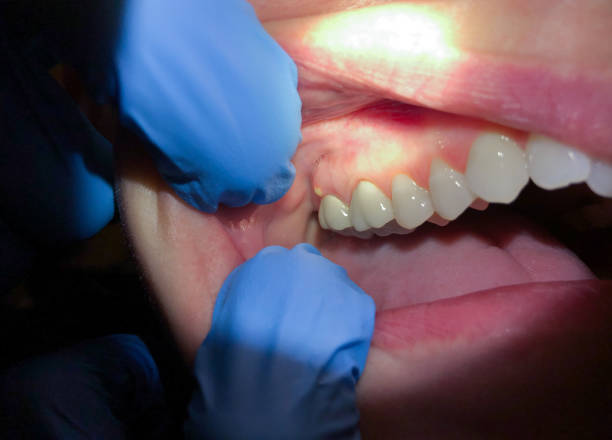 Best Emergency Cosmetic Dentistry (e.g., broken veneers) in Timber Pines, FL
