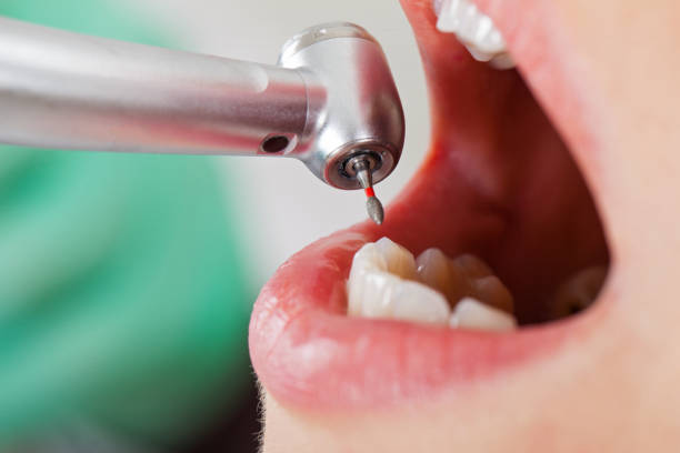 Best Emergency Denture Repair in Timber Pines, FL